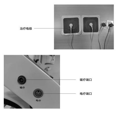 松夏 ZJ-9908脑循环功能障碍治疗经颅磁刺激脑反射电疗仪厂家直营图3
